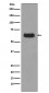 p62/SQSTM1 Antibody 
